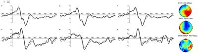 Delayed predictive inference integration with and revision by low-competitive inference alternatives in Chinese narrative text reading